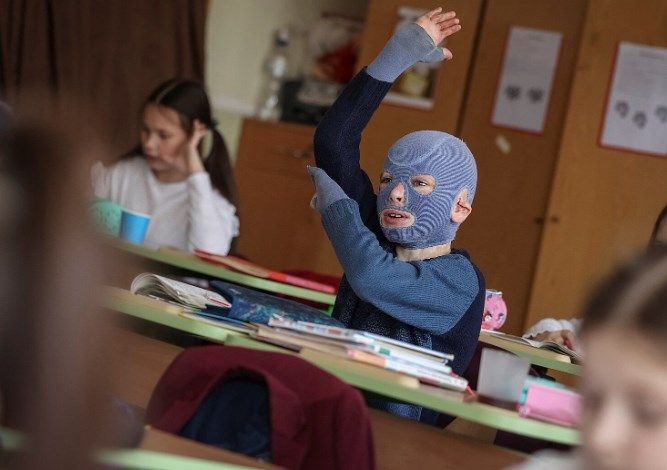 Новини Вінниці - фото з Позаду 32-га операція. Про Ромчика Олексіва, який постраждав від ракетного удару по Вінниці