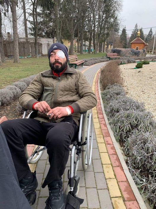 Новини Вінниці - фото з Втратив око за два тижні під Авдіївкою. Історія вінницького захисника Івана Лавренюка