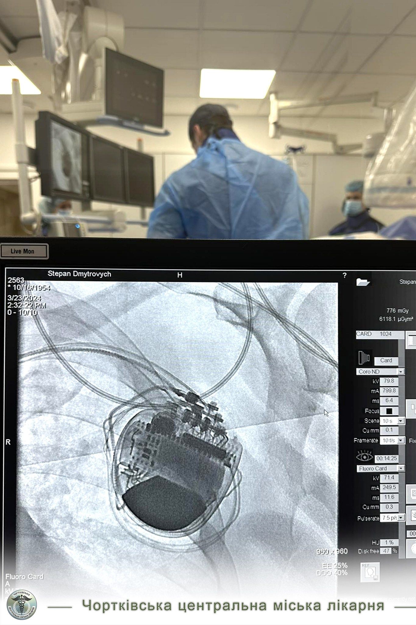 Новини Тернополя - фото з У Чорткові лікарі виконали складну операцію на серці