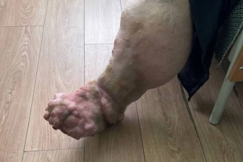 Новини Вінниці - фото з Скандал навколо психоневрологічного інтернату, де за два роки померли 27 людей. Що каже влада?