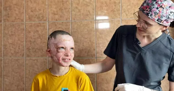 Новини Вінниці - фото з «Ромчик. Мрії не спалити». В Лондоні знімають фільм про хлопчика, який постраждав від ракети у Вінниці