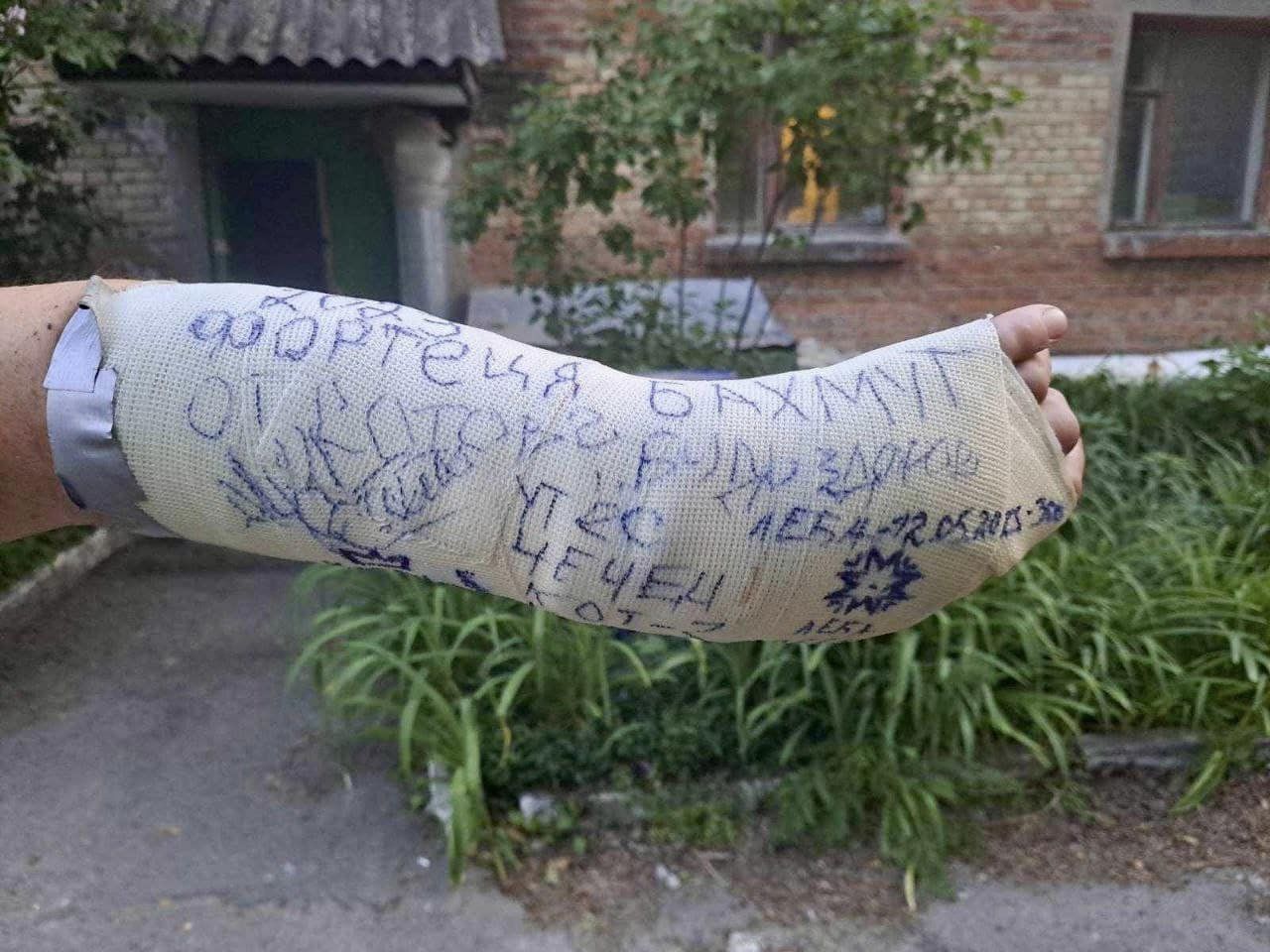 Новини Вінниці - фото з Отримав поранення під Ізюмом та в Бахмуті. Історія бійця з позивним «Лєба»