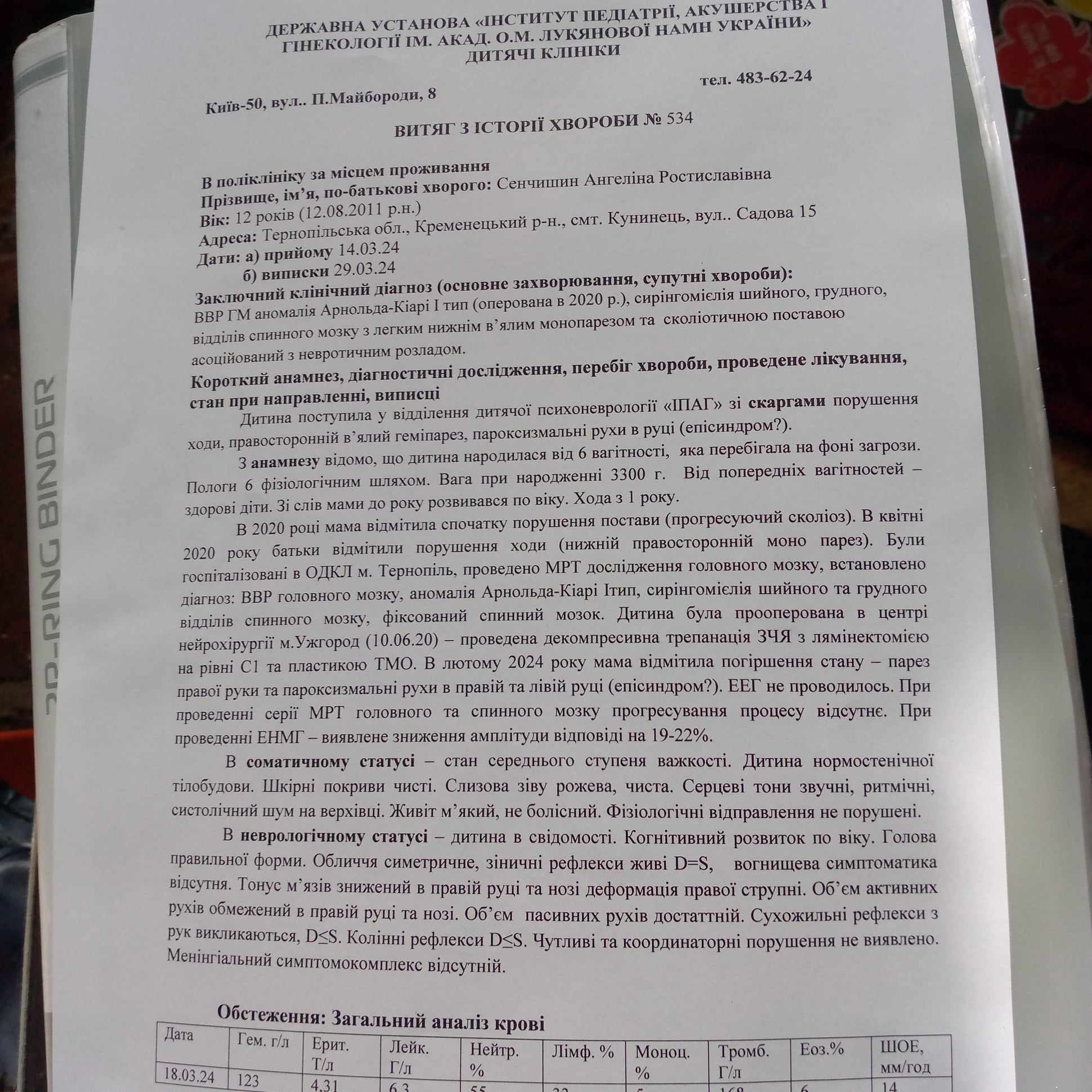 Новини Тернополя - фото з 12-річна кременчанка потребує дороговартісної операції хребта: рідні благають про допомогу