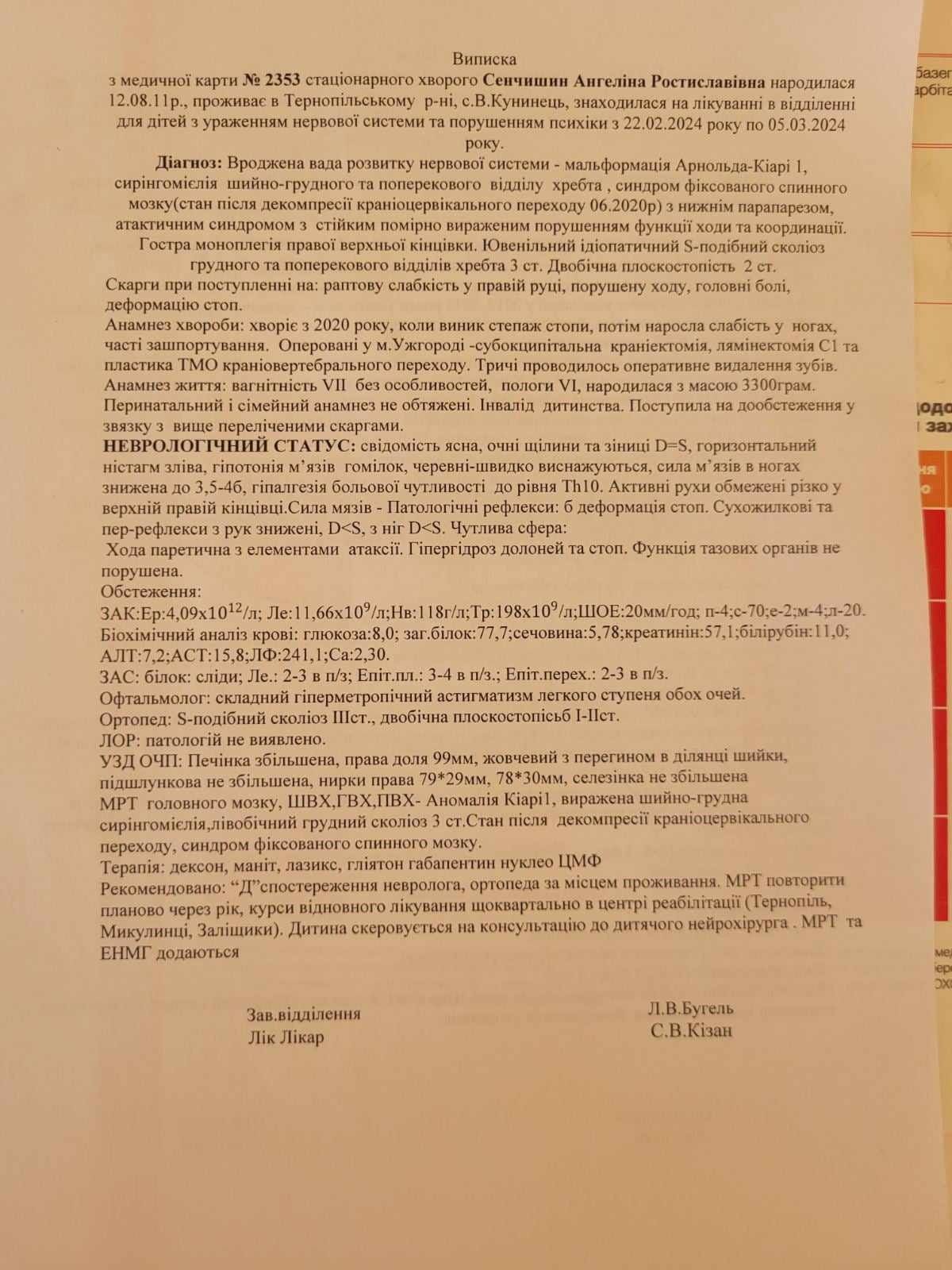 Новини Тернополя - фото з 12-річна кременчанка потребує дороговартісної операції хребта: рідні благають про допомогу