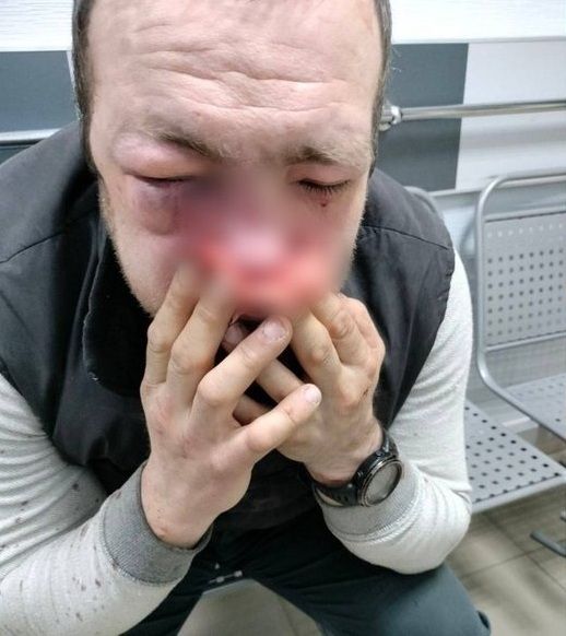 Новини Тернополя - фото з За майже місяць так і не знайшли чоловіків у формі, які побили тернополянина в супермаркеті