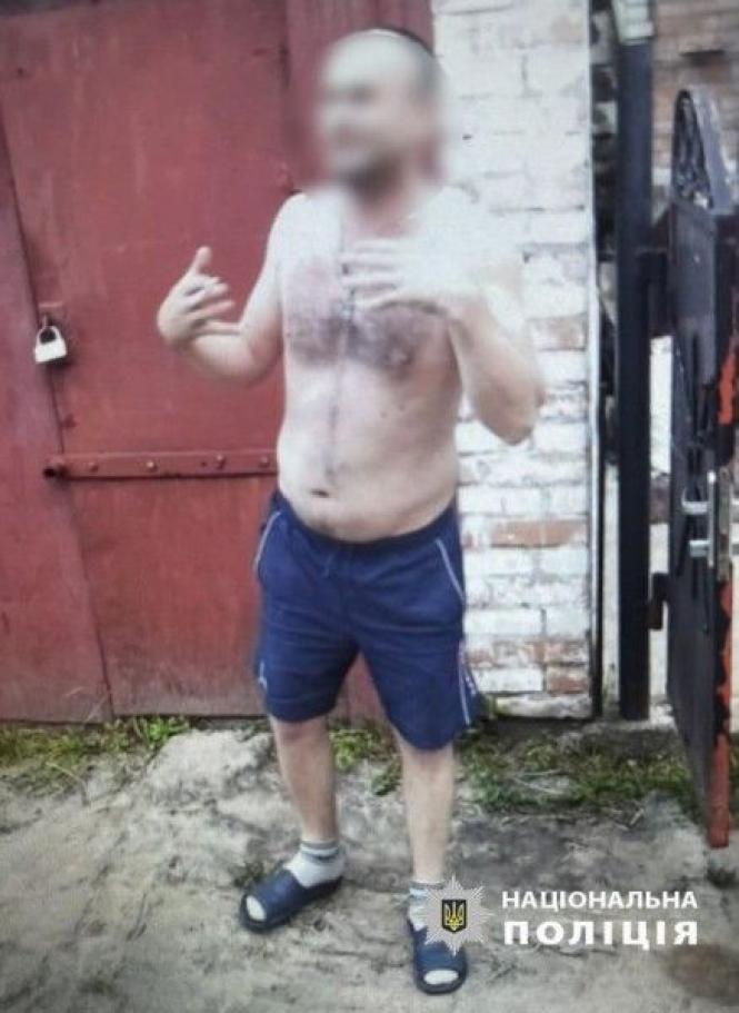 Новини Вінниці - фото з Поліція знайшла чоловіка, який ображав людину з інвалідністю у Сальнику