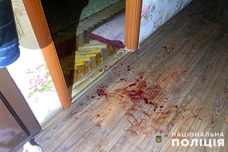 Новини Тернополя - фото з На Злуки чоловік вдарив ножем дружину на очах у шестирічної дитини тернопільські поліцейські затримали чоловіка, який ножем поранив дружину