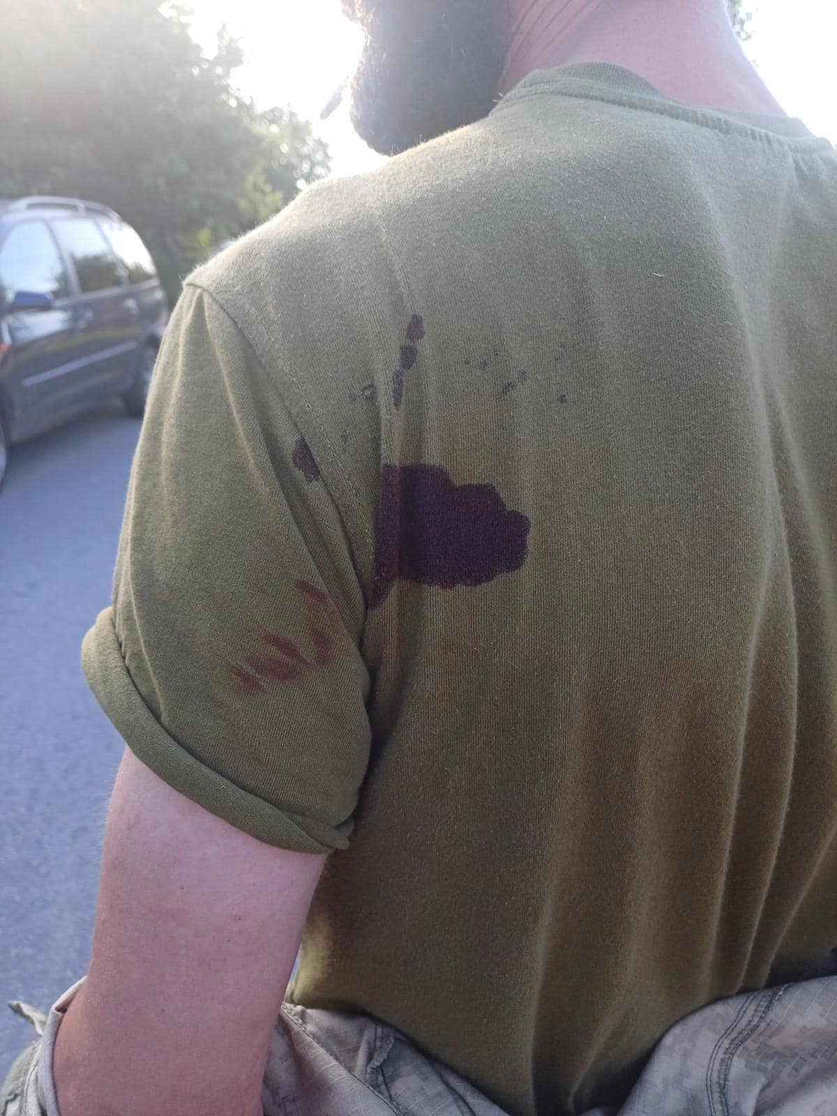 Новини Хмельницького - фото з У Хмельницькому чоловік вдарив ножем військовослужбовця ТЦК та СП