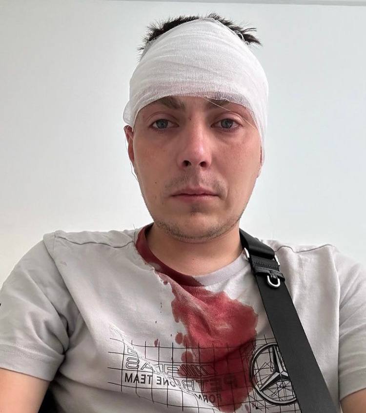 Новини Вінниці - фото з Кастетом по голові. Активіста Дорожнього контролю Вінниці побили на заправці