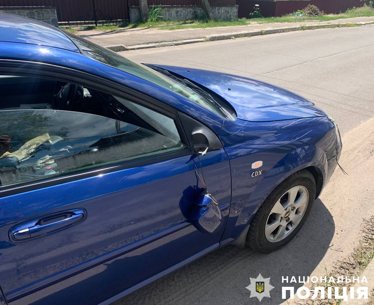 Новини Житомира - фото з У Житомирі на вулиці Саєнка автомобіль збив велосипедиста у житомирі у дтп травми отримав велосипедист: поліція розпочала розслідування