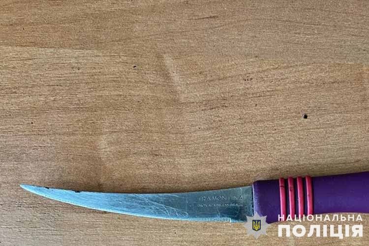 Новини Тернополя - фото з 44-річного тернополянина знайомий важко поранив ножем — поліція