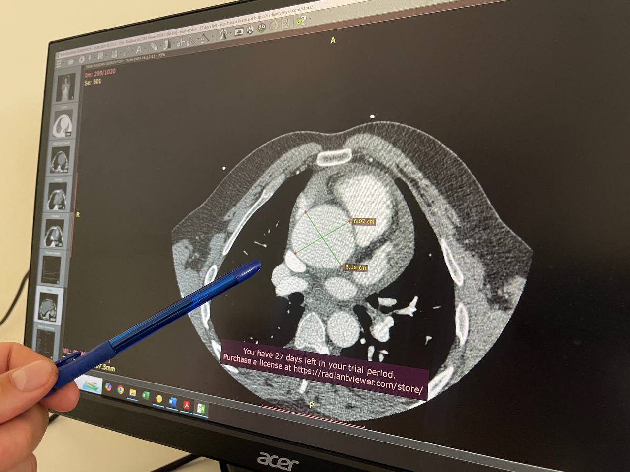 На зображенні може бути: рентген та текст