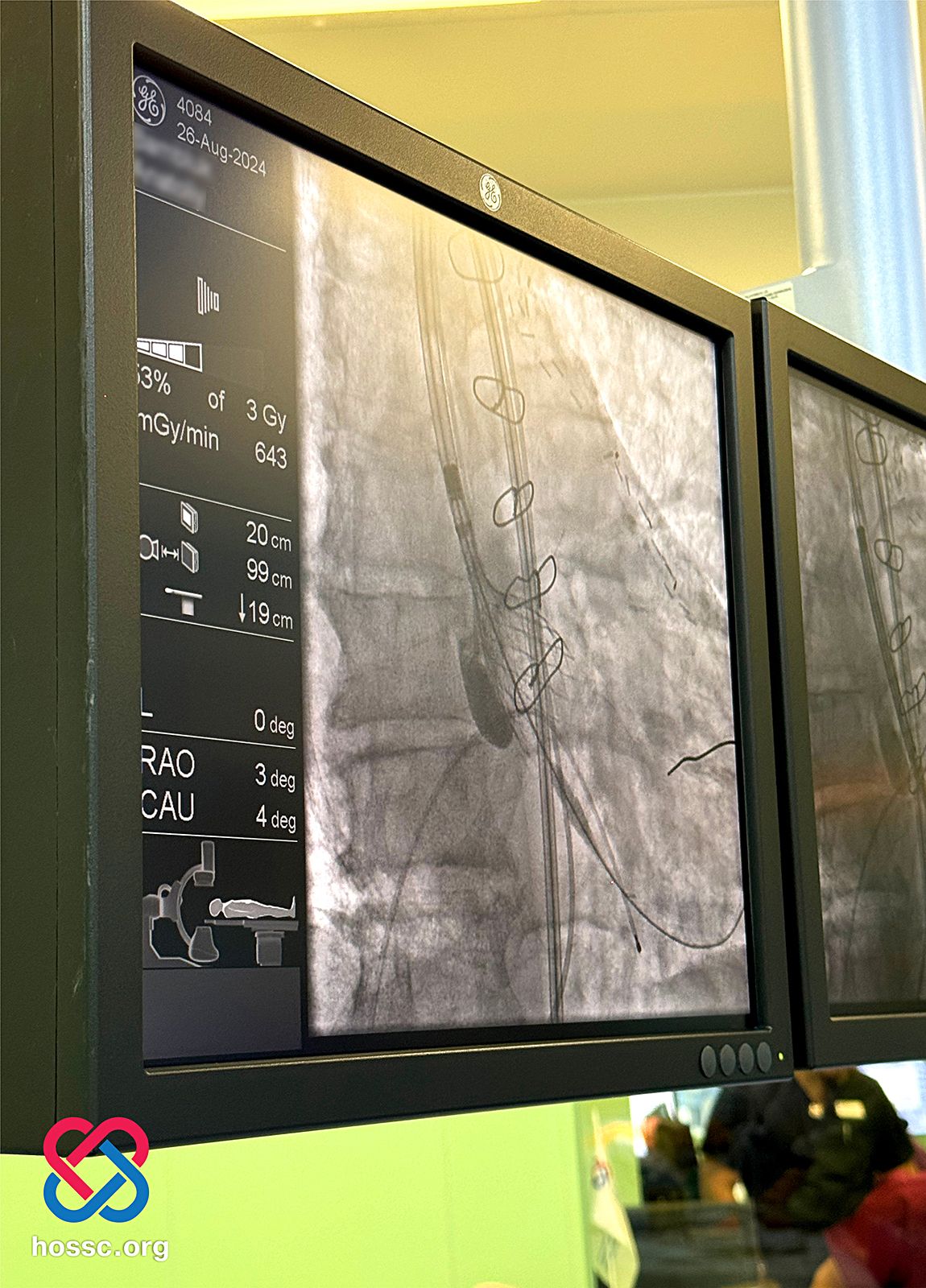 Новини Хмельницького - фото з У Хмельницькому провели складні операції на серці попри масовану ракетну атаку