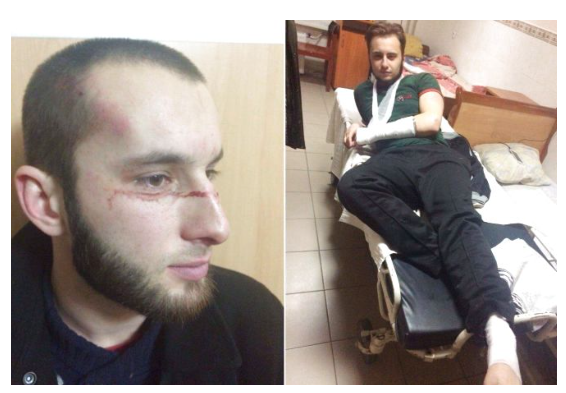 Новини Вінниці - фото з На Коріатовичів збили очільника «Дорожнього контролю». Пригадуємо й інші сутички за участю вінницьких активістів