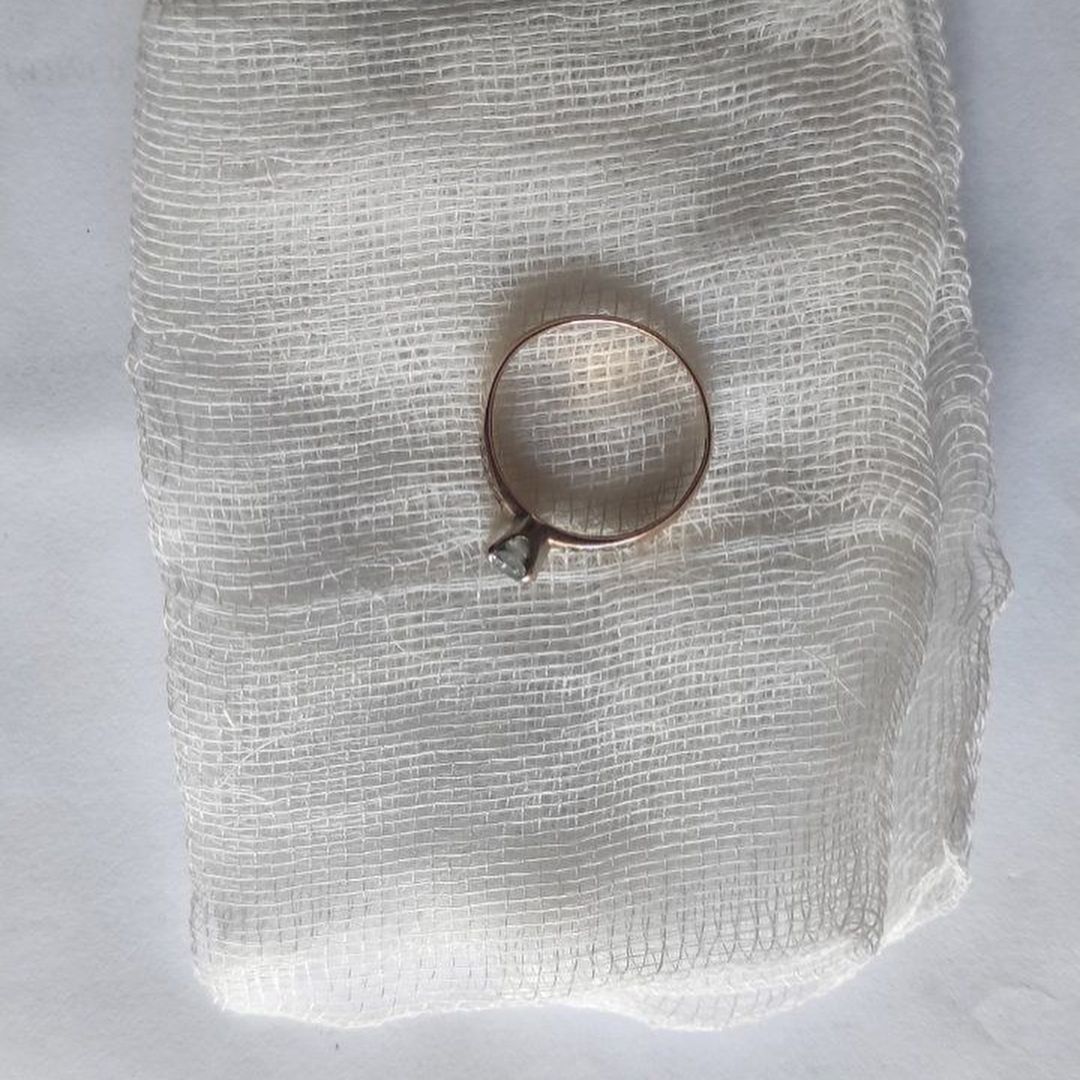 Новини Тернополя - фото з Ковтають прикраси, монети та магніти: лікарка з Тернополя показала, що дістають з дитячих шлунків