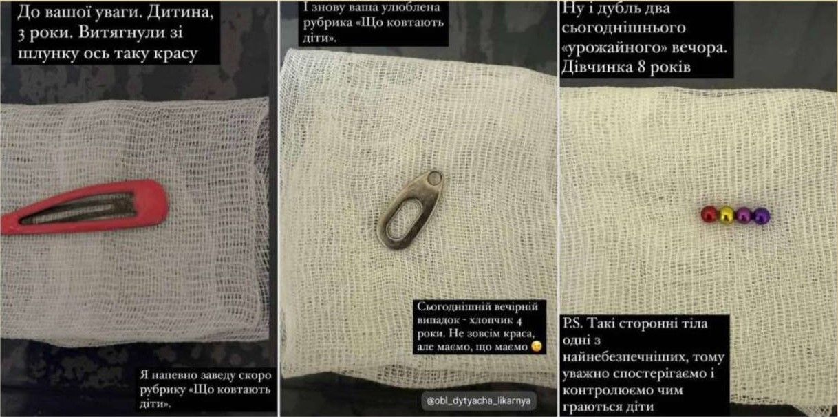 Новини Тернополя - фото з Ковтають прикраси, монети та магніти: лікарка з Тернополя показала, що дістають з дитячих шлунків