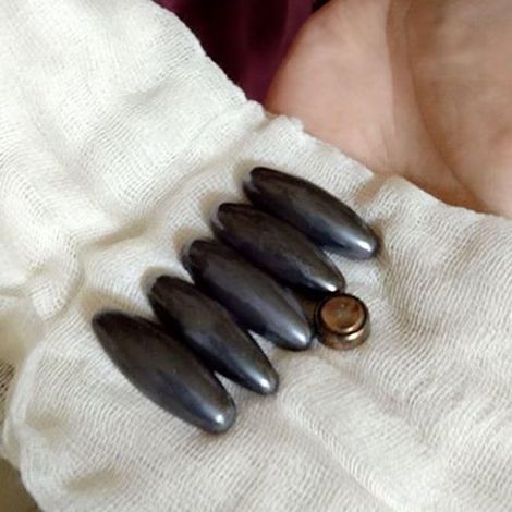 Новини Тернополя - фото з Ковтають прикраси, монети та магніти: лікарка з Тернополя показала, що дістають з дитячих шлунків