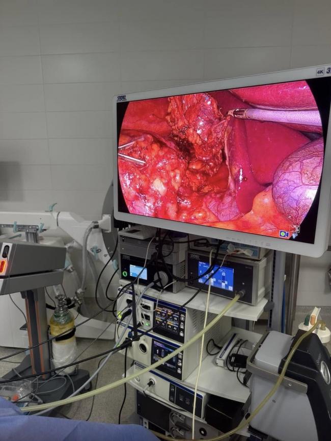 Новини Вінниці - фото з Вінницькі лікарі видалили пухлину наднирника за 55 хвилин. Пацієнтка уже відновлюється