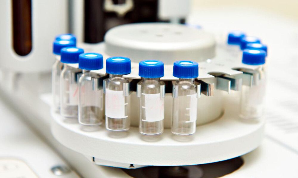 Новини Козятина - фото з Автоматизація лабораторних досліджень за допомогою сучасних біохімічних аналізаторів (Новини компаній)