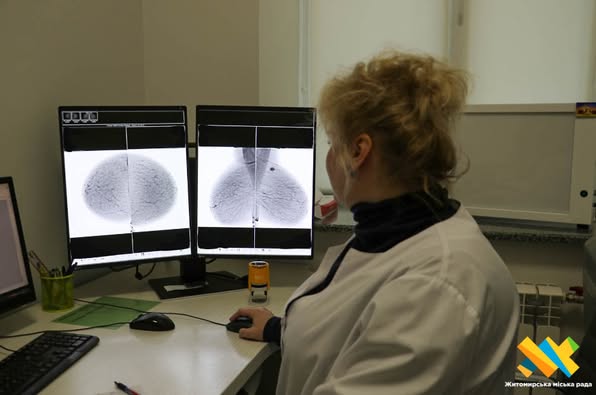 Новини Житомира - фото з У Житомирській області щороку виявляють 350–400 нових випадків раку молочної залози: мамографія рятує життя