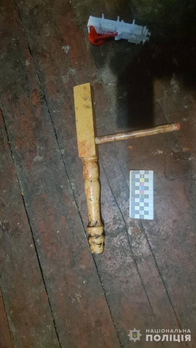 Новини Вінниці - фото з Жінка під час п'янки побила сусіда табуреткою, а потім всадила йому ножа в живіт