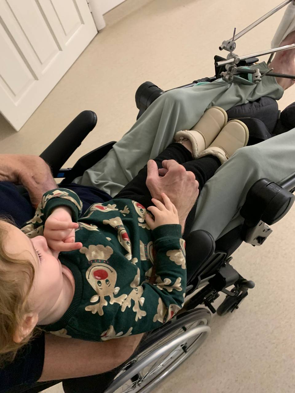 Новини Тернополя - фото з «Мені казали моліться, щоб вижив — і сталося диво». Захисник мріє стати на ноги