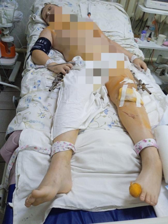 Новини Вінниці - фото з Медики повернули 12-річного хлопчика до життя після страшної аварії