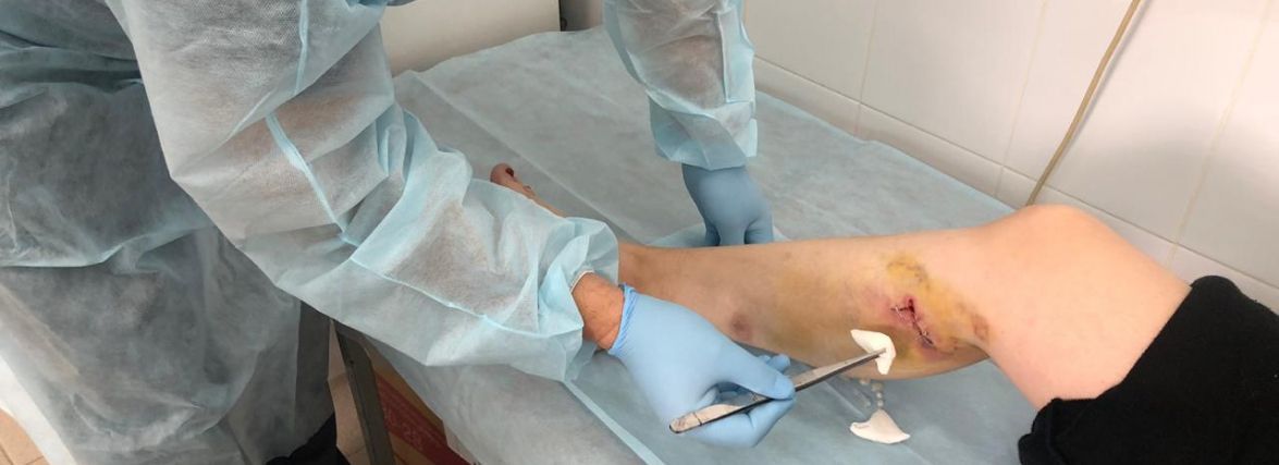 Новини Вінниці - фото з «Такого ще не було — за день до трьох укусів дітей тваринами», — розповідають вінницькі медики