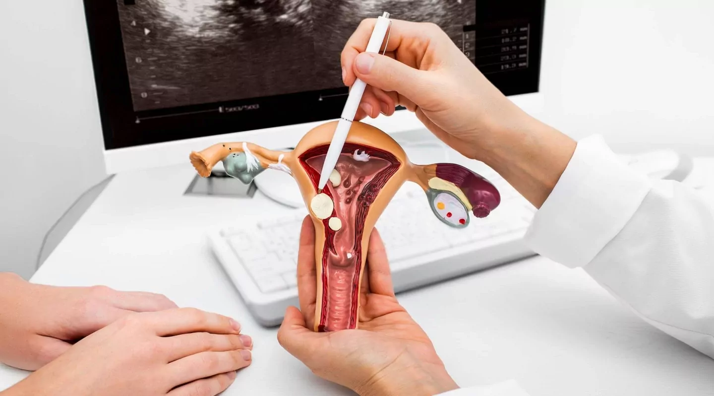 Новини Вінниці - фото з Діагностика та видалення поліпів шийки матки та ендометрію в «ОН Клінік Дніпро» (Новини компаній)