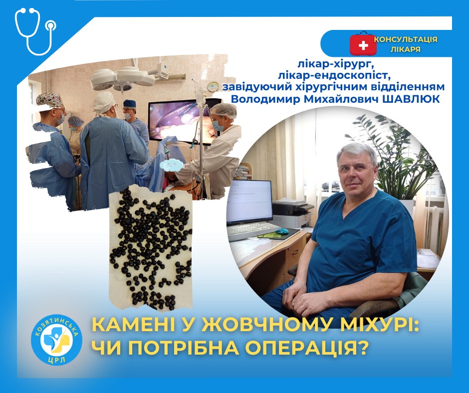 Новини Козятина - фото з Чи потрібна операція, коли камені у жовчному? Пояснють лікарі Козятинської ЦРЛ