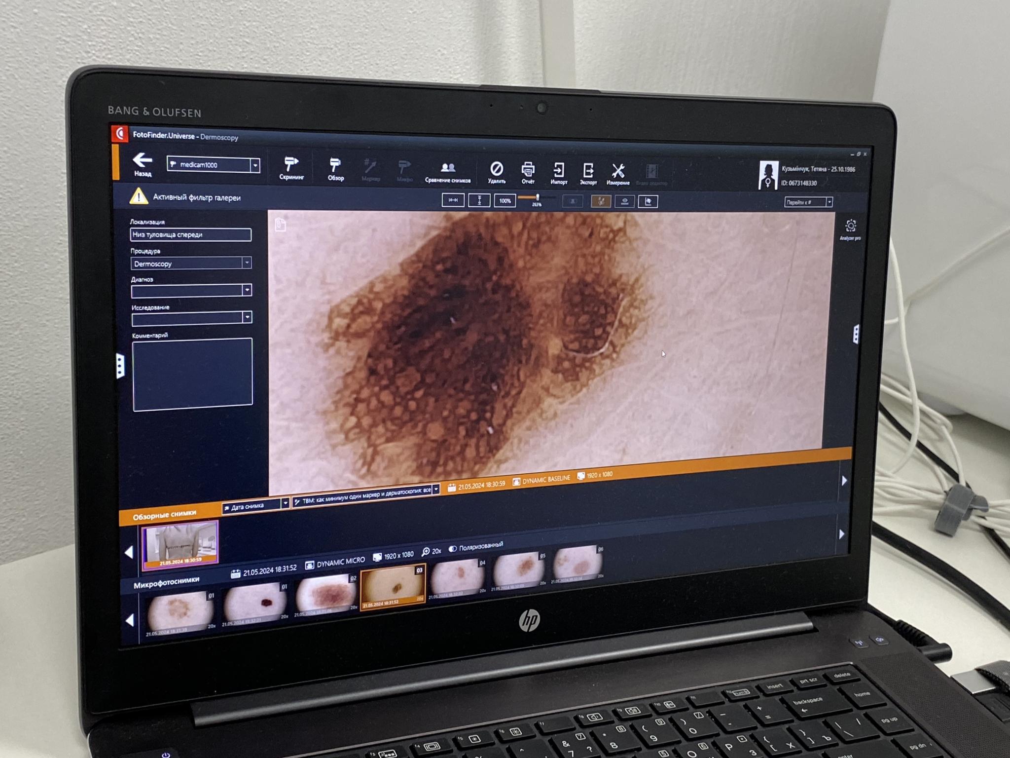 Новини Вінниці - фото з Вінниця отримала захист від раку шкіри (Новини компаній)