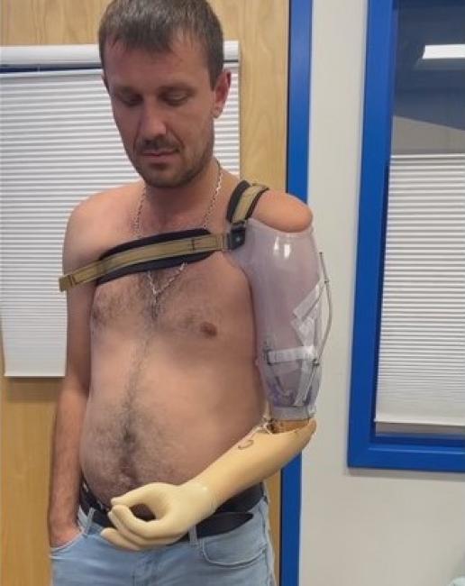 Новини Вінниці - фото з «Держава допомогла з житлом, а клініка — з реабілітацією»: як ветеран Ярослав Павлик знайшов підтримку і себе після поранення