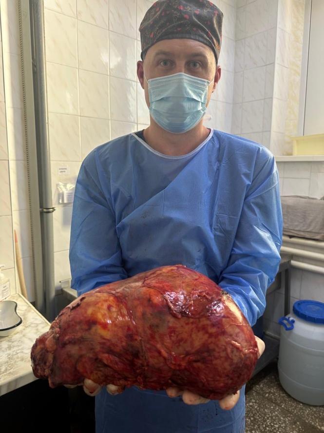 Новини Вінниці - фото з У Вінницькій обласній лікарні успішно видалили гігантську пухлину нирки