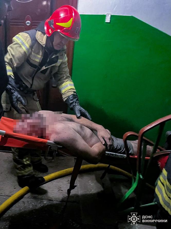 Новини Вінниці - фото з Пожежа через куріння: вінничанина винесли з задимленої квартири