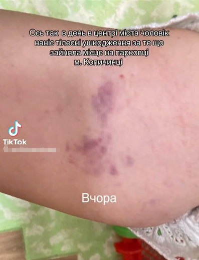 Новини Тернополя - фото з 510 грн — такий штраф заплатив чоловік, який вдарив жінку за місце на парковці