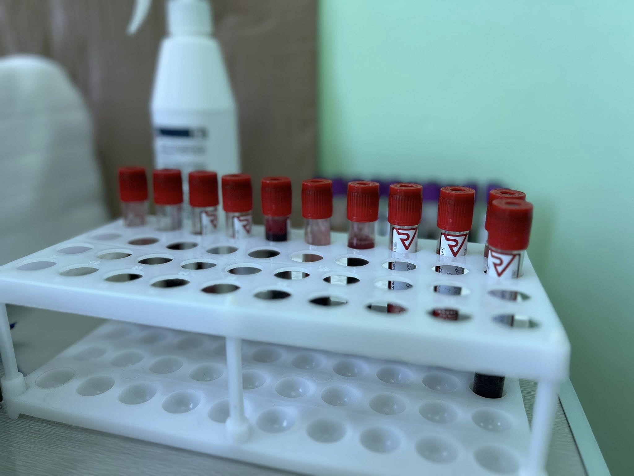 Новини Тернополя - фото з Дорський автобус провів забір крові у Чорткові