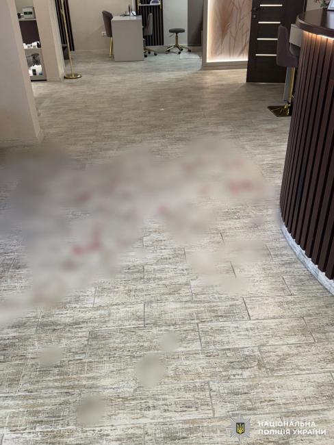 Новини Вінниці - фото з В Тульчині сварка в перукарні переросла в ножове поранення