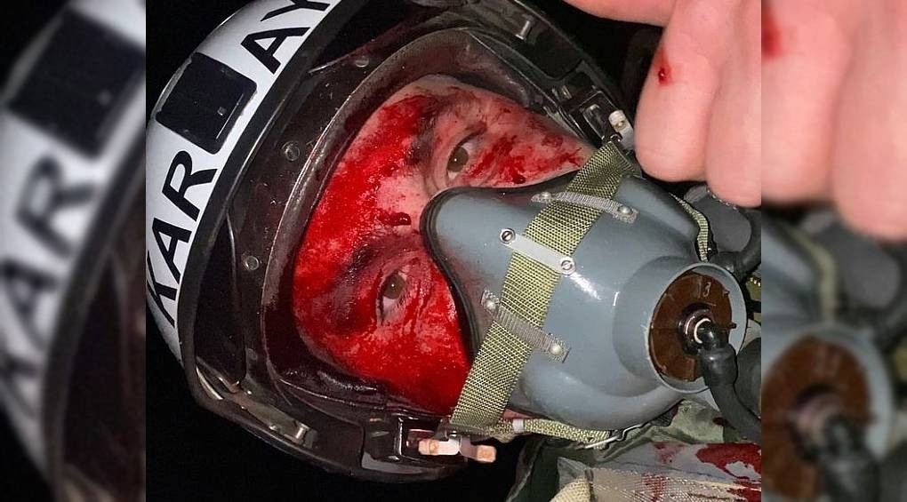 Новини Вінниці - фото з Вчора була одна з найбільших атак по Вінниччині: коли ще наша область була під прицілом ворога?