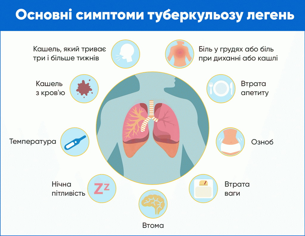 Новини Вінниці - фото з На Вінниччині зареєстровано 425 випадків туберкульозу. Які симптоми і де лікують хворих?