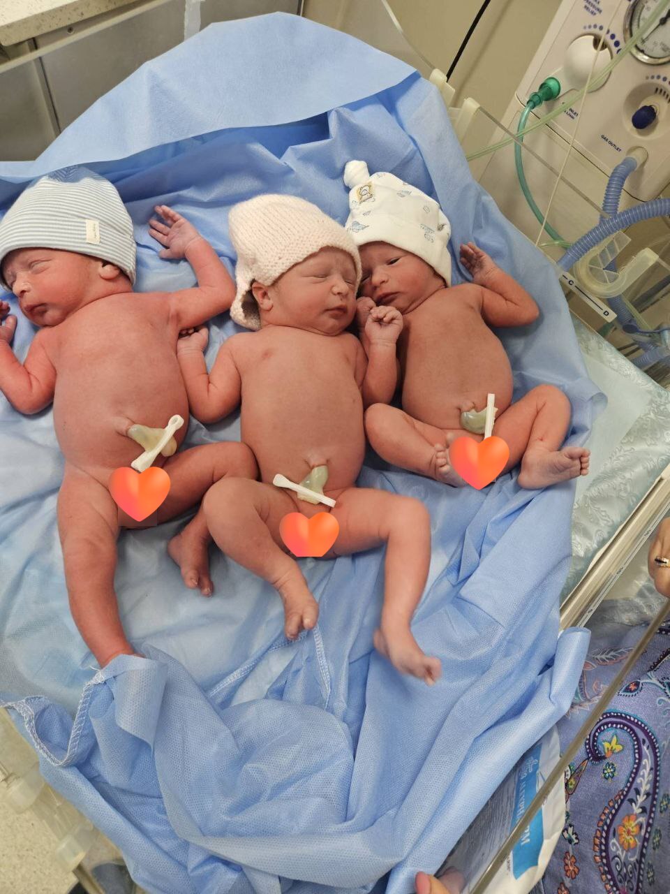 Новини Житомира - фото з У Житомирі народилася трійня — дві дівчинки та хлопчик