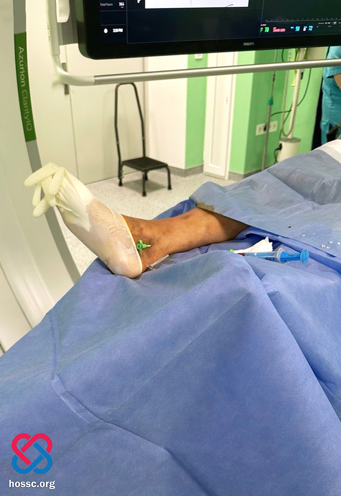 Новини Хмельницького - фото з У Кам'янці кардіохірурги врятували чоловіка від ампутації ноги