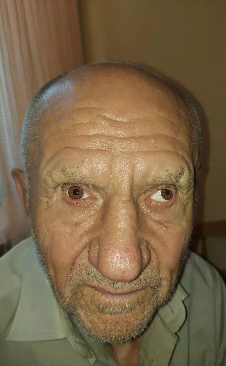 Новини Тернополя - фото з Хтось на фронт, хтось у декрет. Чому за три роки винних у сліпоті 22 пацієнтів лікарні так і не покарали