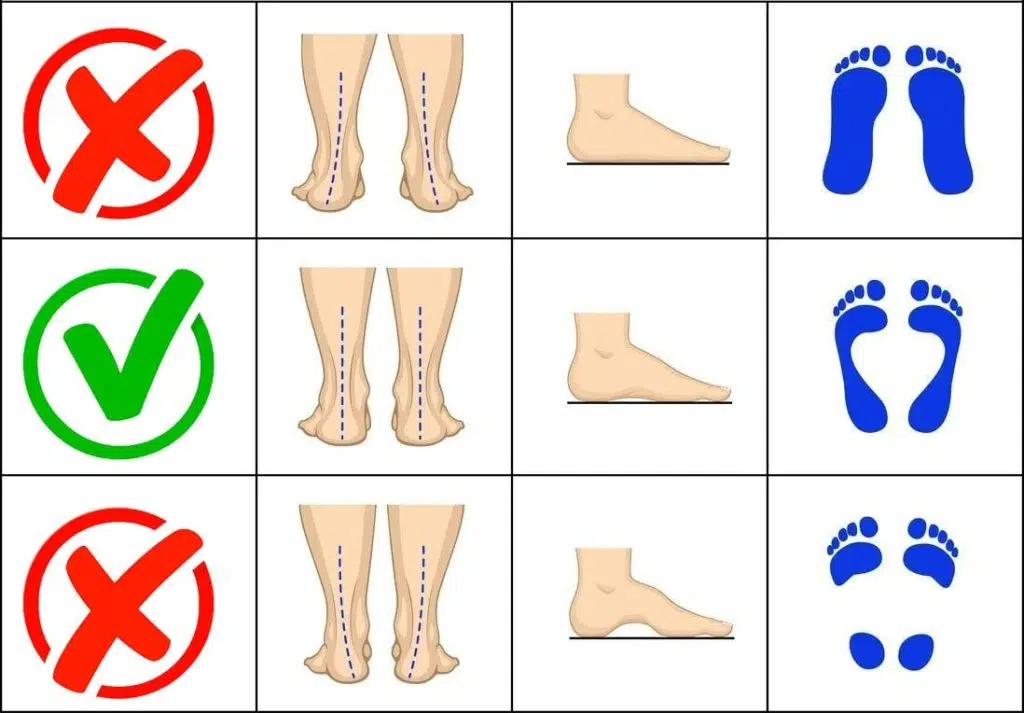 Новини Вінниці - фото з Вплив індивідуальних устілок на поставу, ходу та профілактику болю (Новини компаній)