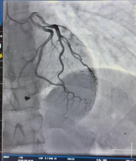 Новини Вінниці - фото з Народився вдруге – у Вінниці з серця чоловіка дістали металевий уламок