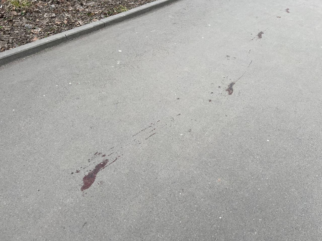 Новини Вінниці - фото з «Ми вже печемо хліб»: як центр Вінниці відновлюється після обстрілу?