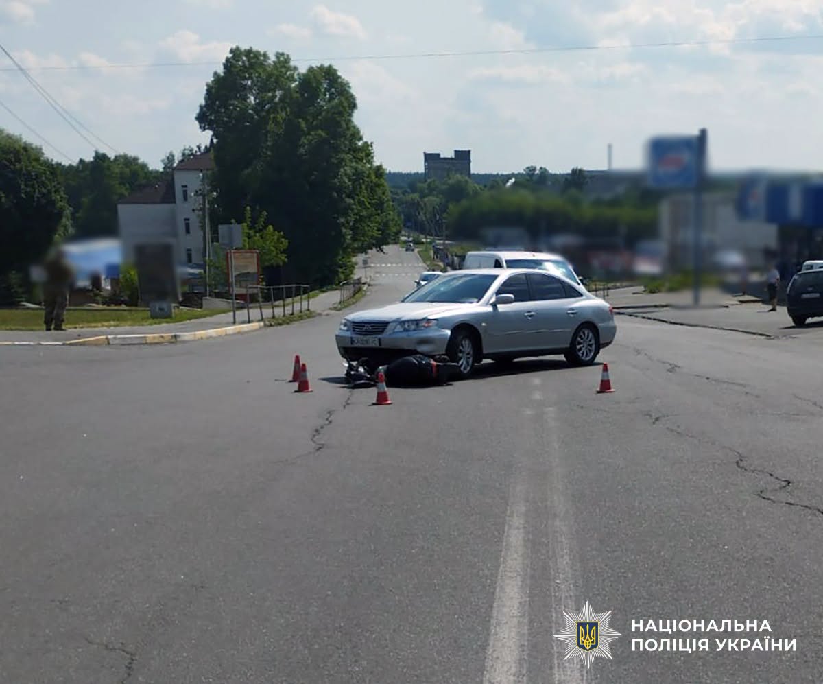 Новини Житомира - фото з У Малині при зіткненні автівки і скутера постраждала пасажирка двоколісника