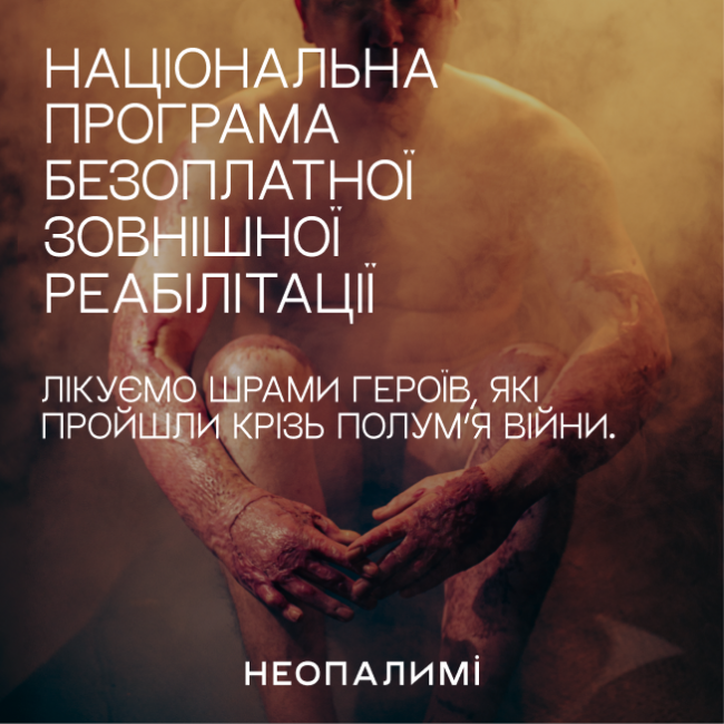 Новини Вінниці - фото з У Вінниці постраждалі від війни можуть безкоштовно лікувати опіки та рубці за програмою «Неопалимі»