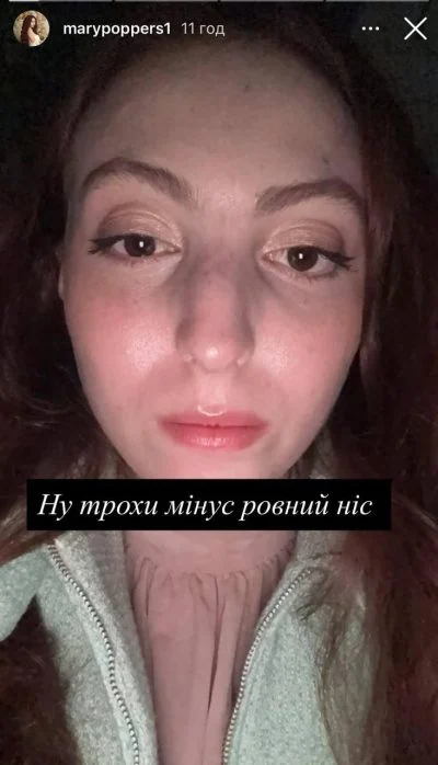 Новини Вінниці - фото з Заламаний ніс та очниця: донька Олі Полякової вперше вийшла на зв'язок після ДТП