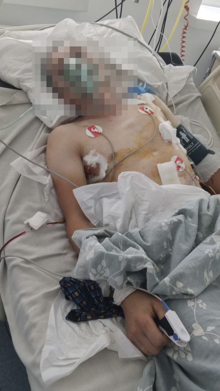 Новини Житомира - фото з ДТП у Житомирі: п’яні командири за кермом, важко травмований військовий — і спроби все «зам’яти»?