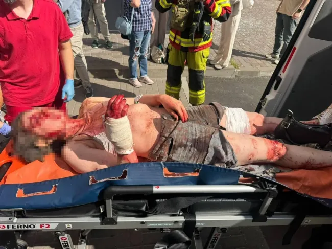 Новини Вінниці - фото з Росіяни вдарили по телеканалу «Ми — Україна» під час прямого ефіру. Є постраждалі